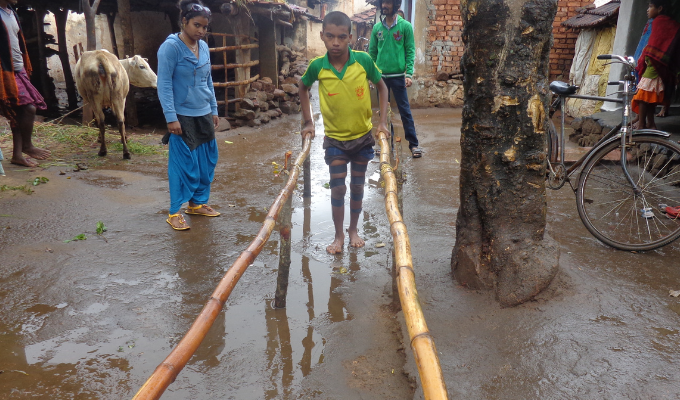 A young boy with a locomotor disability is being given therapy through parallel bars